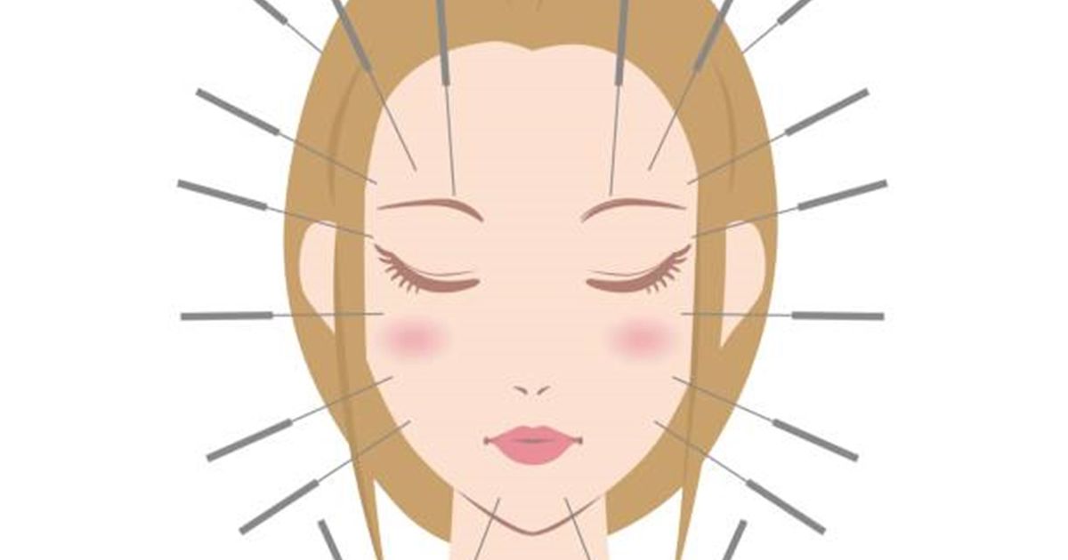 新しいスタイル 健康 美容 ダイエット目的貼るだけ美容鍼 円皮鍼 50本 貼る場所の説明入り 貼るだけ美容鍼(円皮鍼)25本 貼る場所の説明入り!健康・美容・ダイエット目的